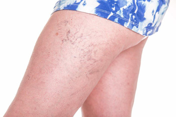 Hautbehandlungen mit Laser Hautbehandlungen mit Laser