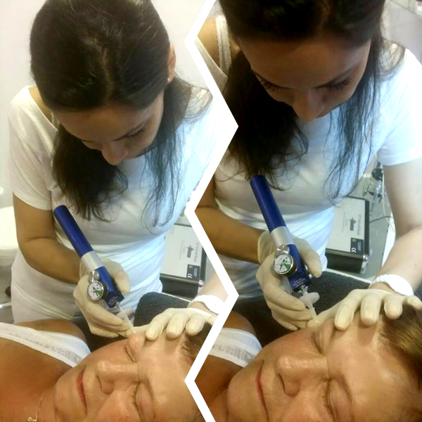 Corboxytherapie Alfeld Corboxytherapie Alfeld